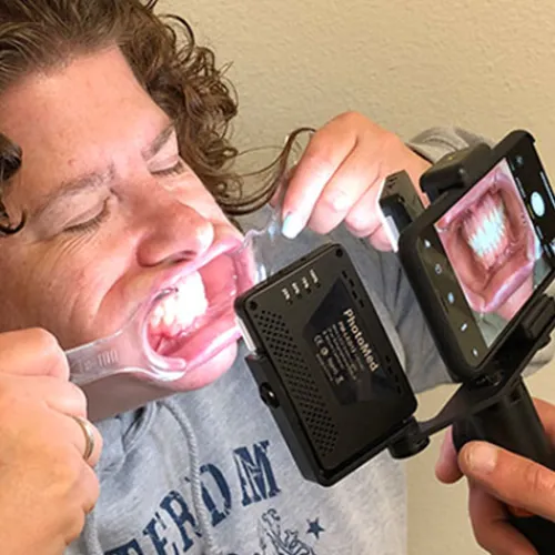 Photomed Smartphone Accessories|Video & Led Lighting>Dental LED Light for Smartphone